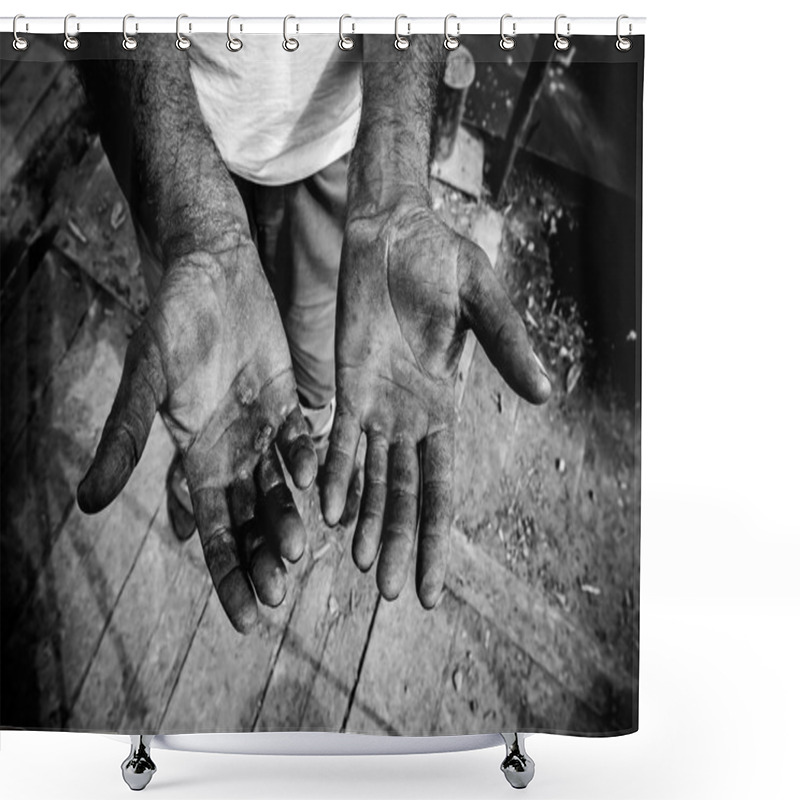 Personality  Injured Open Palms Shower Curtains