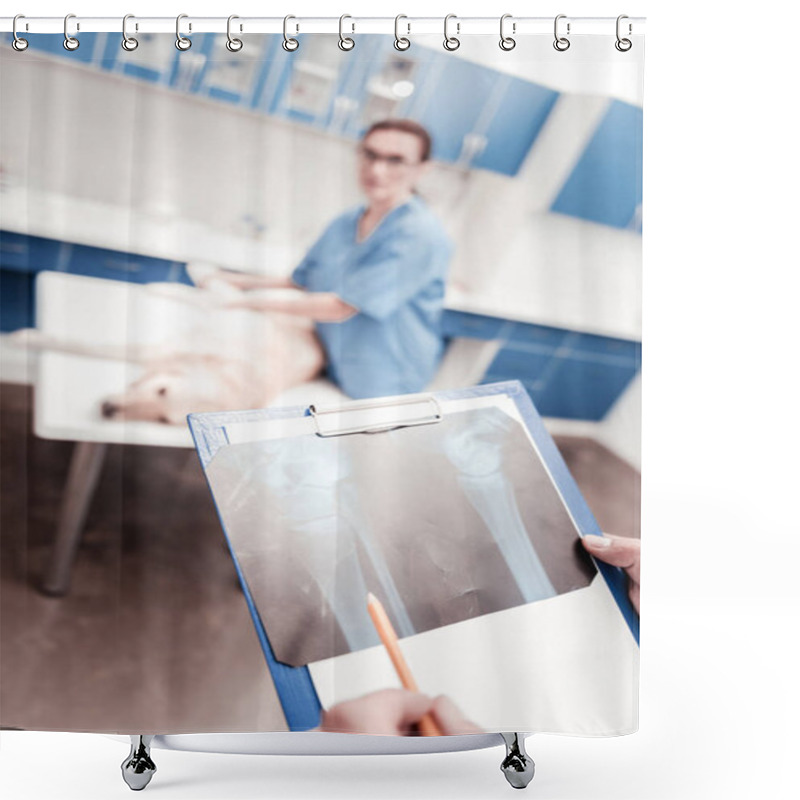 Personality  Close Up Of Hands That Demonstrating X-ray Photo Shower Curtains