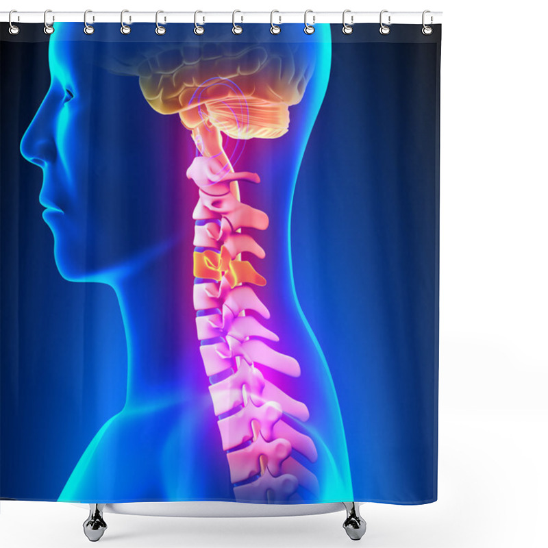 Personality  C4 Disc - Cervical Spine Shower Curtains