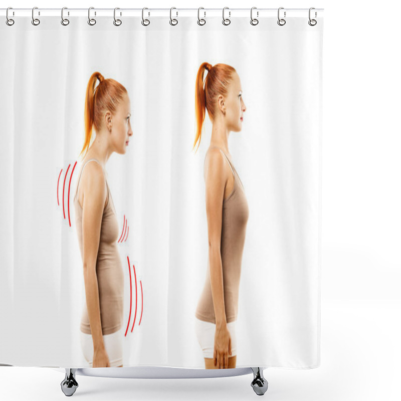 Personality  Young Woman With Position Defect And Ideal Bearing Shower Curtains