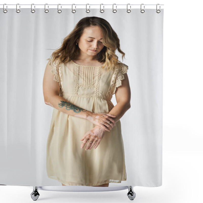 Personality  A Young Woman With Vitiligo Stands Thoughtfully, Showcasing Her Unique Beauty In A Soft Dress. Shower Curtains