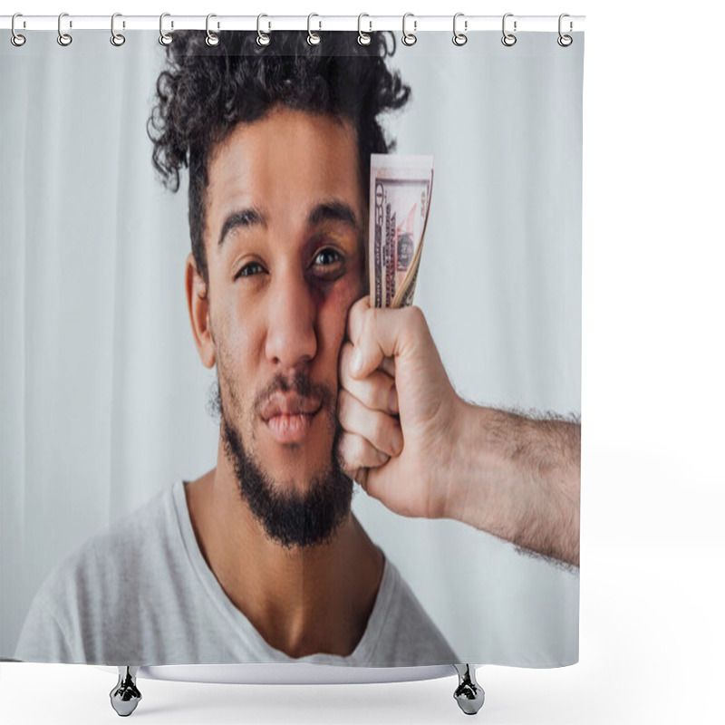 Personality  African American Man With Bruise Looking At Camera Near Male Hand Holding Cash Isolated On Grey Shower Curtains