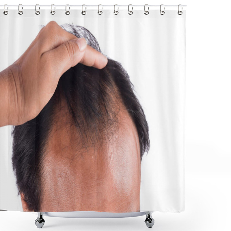 Personality  Bald Head Of Young Man O White Background Shower Curtains