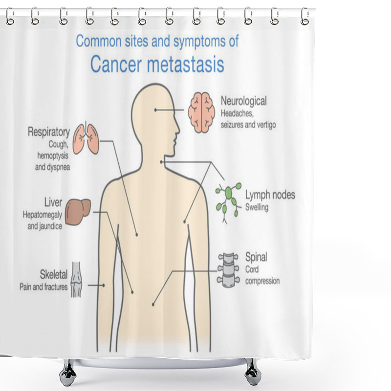 Personality  Most Common Sites And Symptoms Of Cancer Metastasis. Shower Curtains