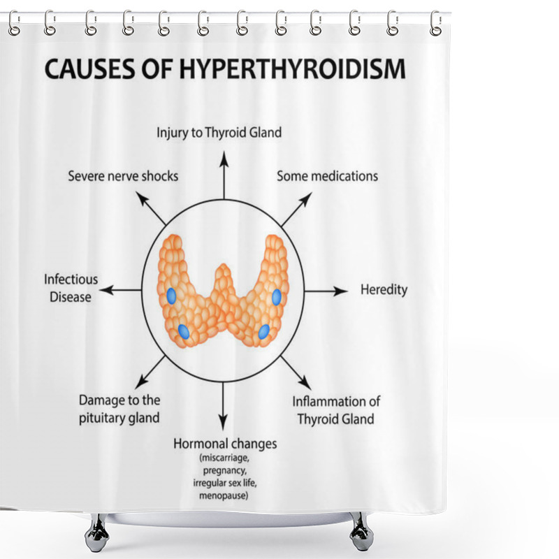 Personality  The Causes Of Hyperthyroidism Of The Thyroid Gland. Infographics. Vector Illustration On Isolated Background. Shower Curtains