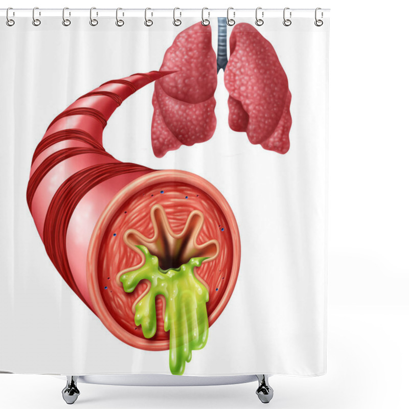 Personality  Bronchitis Anatomy Concept Shower Curtains