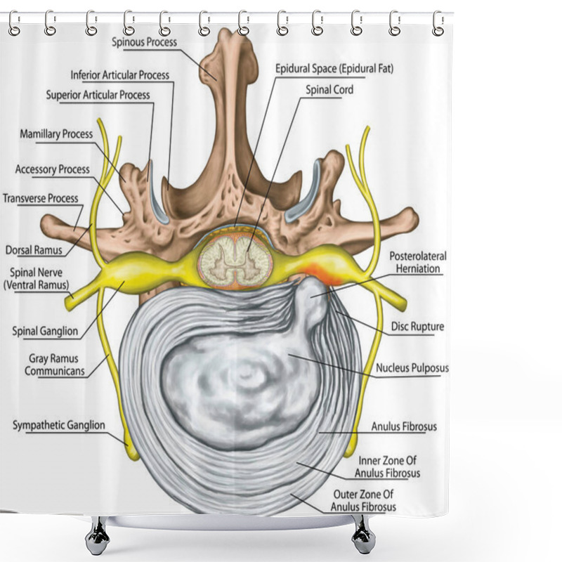 Personality  Lumbar Disk Herniation, Herniated Disc, Lumbar Vertebra, Lumbar Spine, Intervertebral Disk, Nervous System, Nerve Root, Spinal Cord, Vertebra, Anatomy Of Human Skeletal And Nervous System, Superior View Shower Curtains