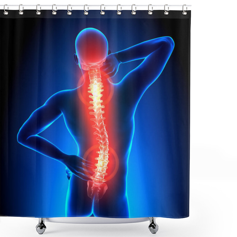 Personality  Male Hurt Backbone -Pain Shower Curtains