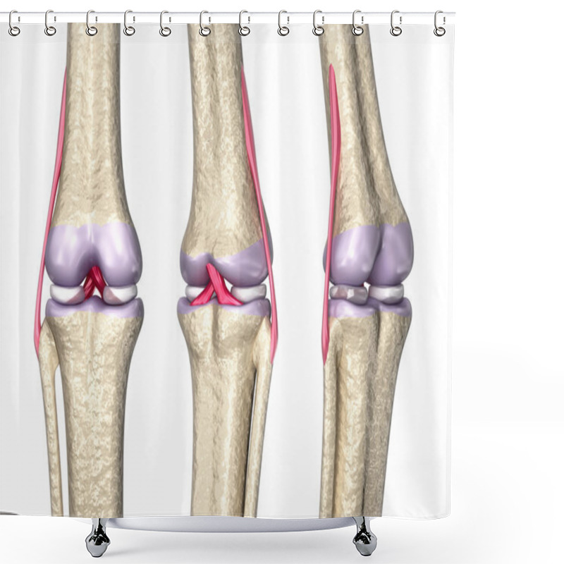 Personality  Knee Joint Anatomy, 3D Model Shower Curtains