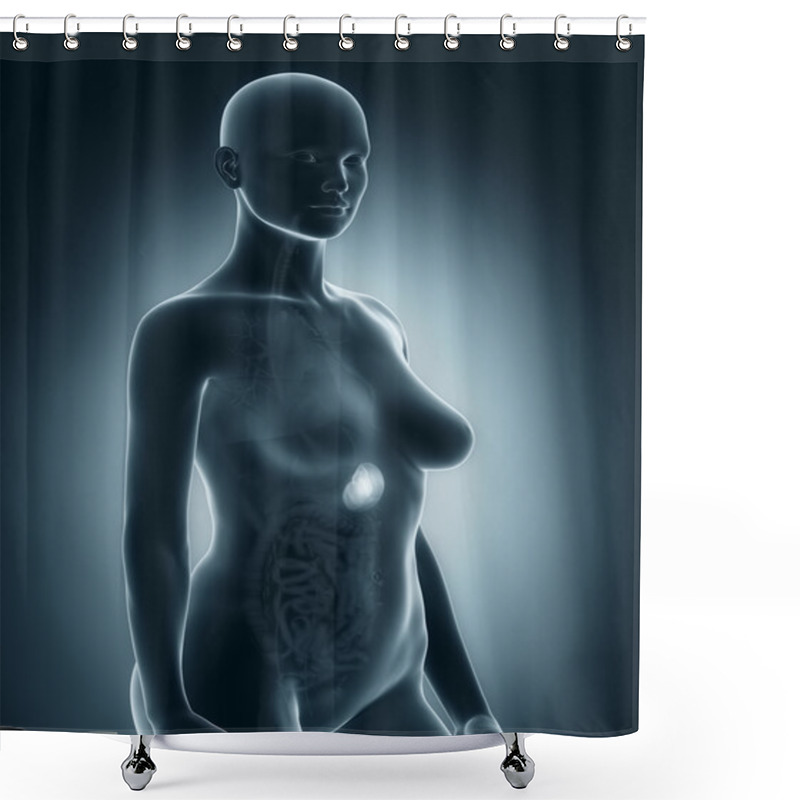 Personality  Woman Spleen Anatomy X-ray Shower Curtains