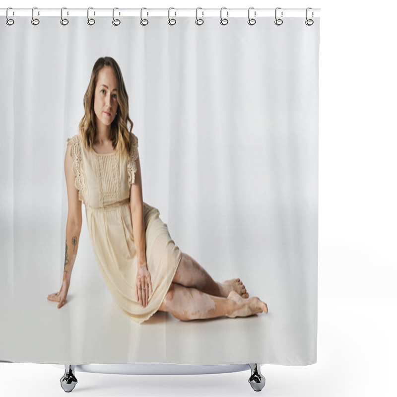 Personality  Young Woman With Vitiligo Poses Gracefully, Showcasing Her Unique Skin And Beauty. Shower Curtains