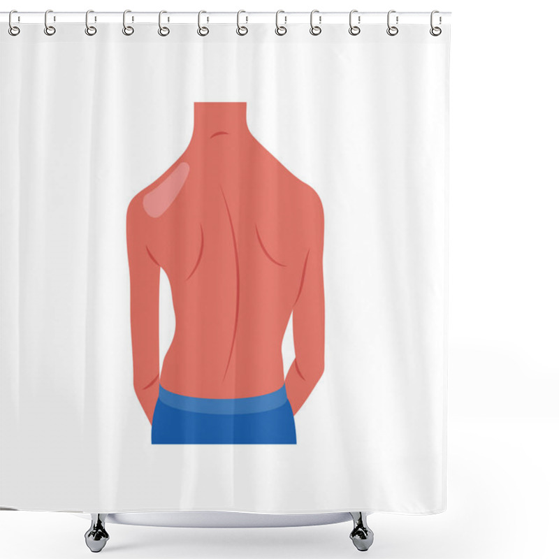 Personality  Scoliosis Flat Vector Illustration Isolated Shower Curtains