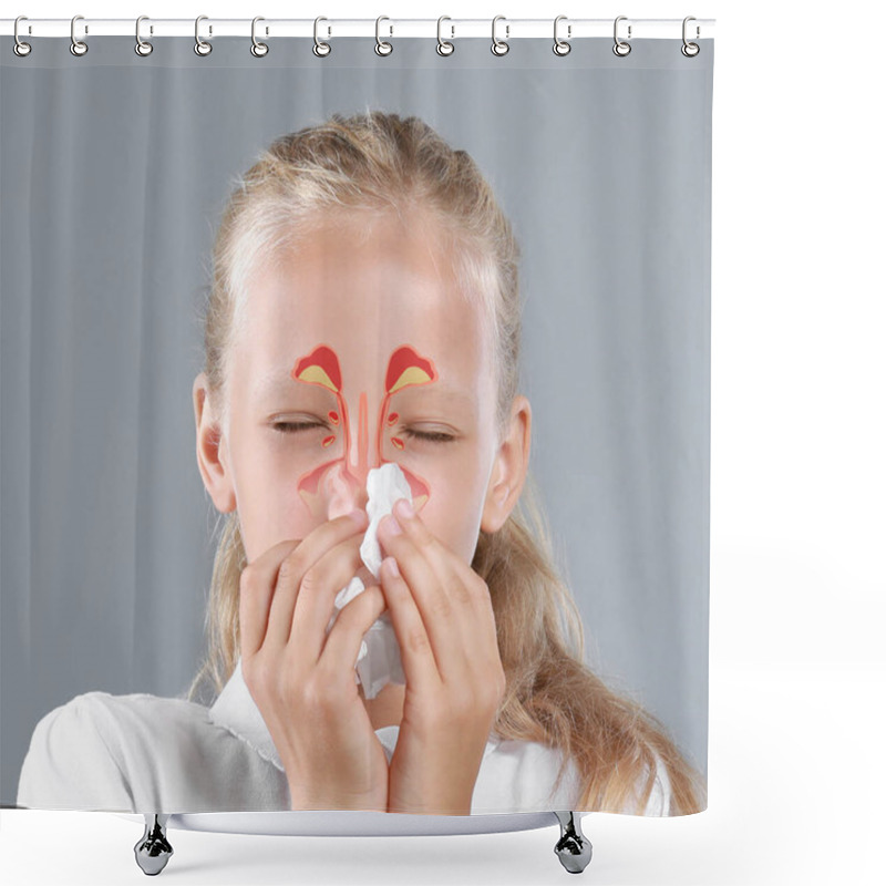 Personality  Little Girl Suffering From Runny Nose As Allergy Symptom. Sinuses Illustration On Face Shower Curtains