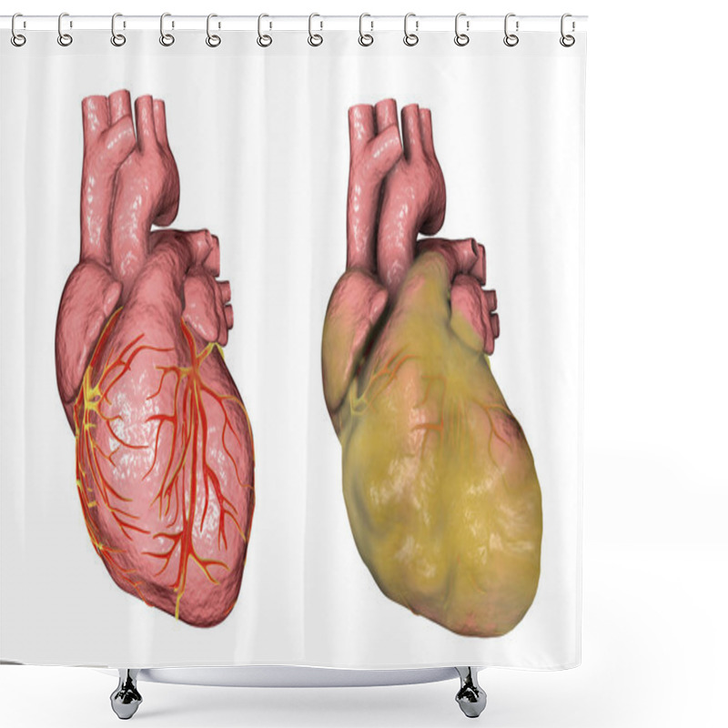 Personality  Obese Heart, Illustration Shower Curtains