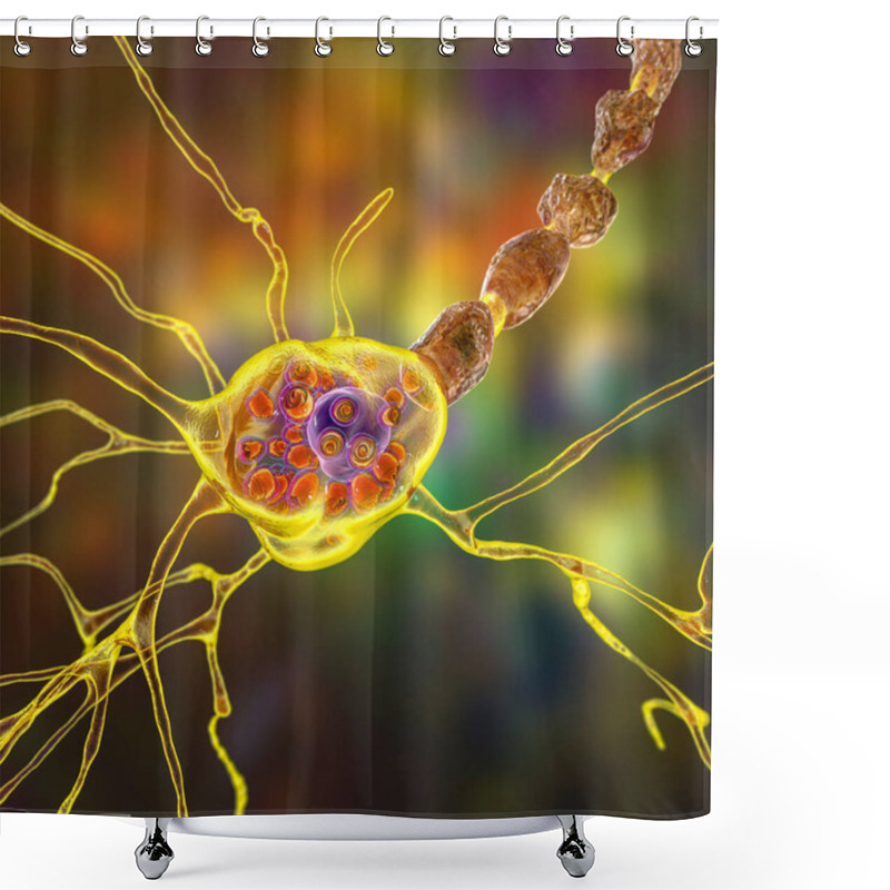 Personality  Brain Neurons In Lysosomal Storage Diseases, Tay-Sachs, Niemann-Pick, Fabry And Other. 3D Illustration Showing Swollen Neurons With Lamellar Inclusions Due To Accumulation Of Gangliosides In Lysosomes Shower Curtains