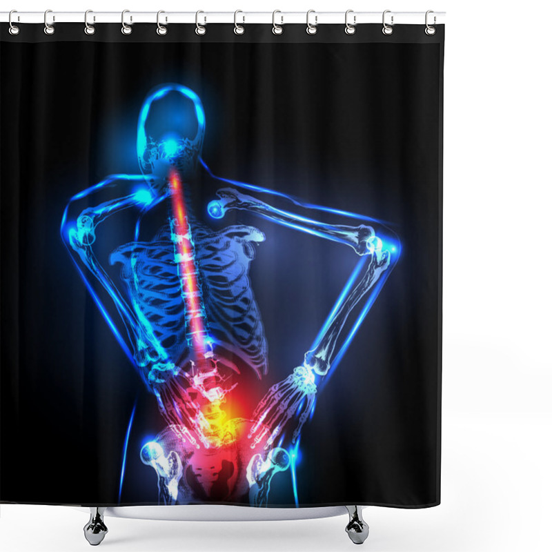 Personality  Human Backbone In X-ray, Back Pain, Easy Editable Shower Curtains