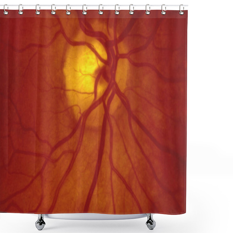 Personality  Fundus Photography Of The Back Of The Eye - A Normal Human Retina Shower Curtains