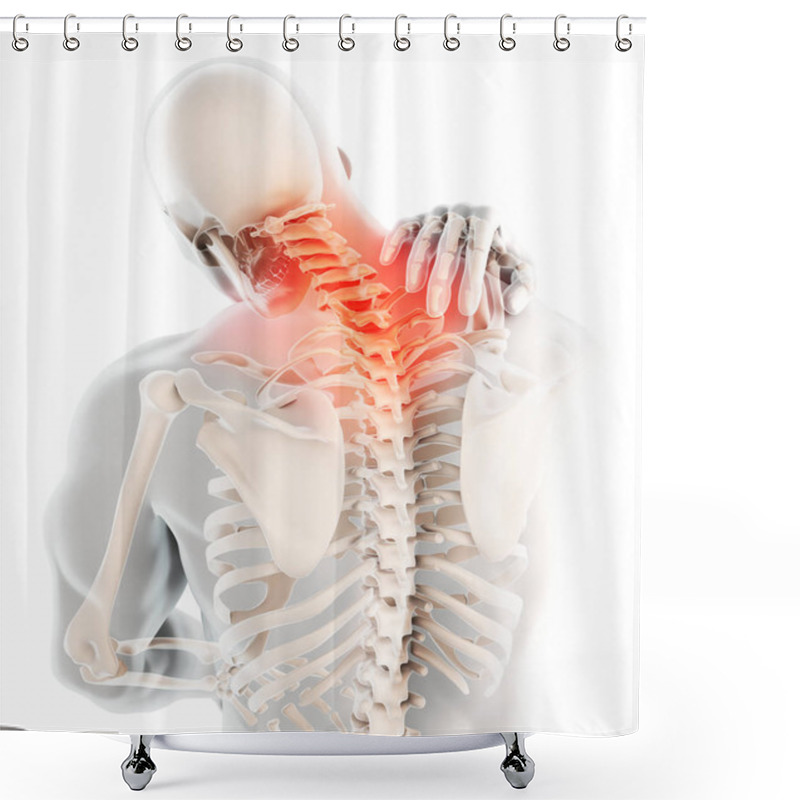 Personality  3D Illustration, Neck Painful - Cervical Spine Skeleton X-ray, Medical Concept. Shower Curtains