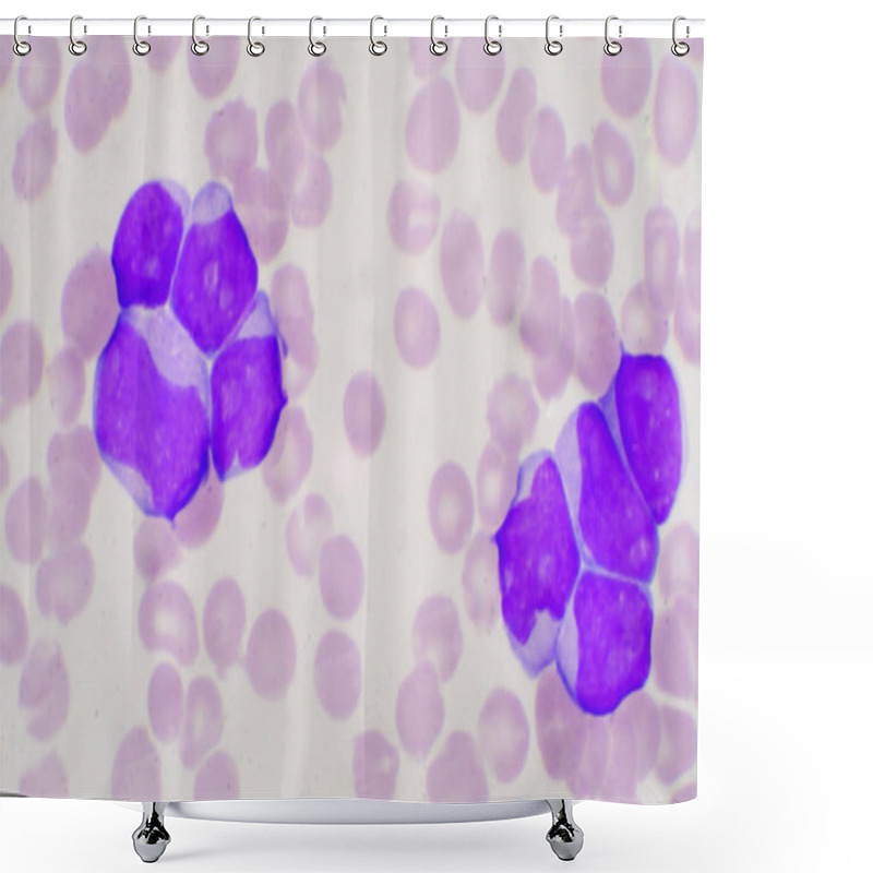 Personality  Blast Cell In Leukemia Pateins In Blood Smear. Shower Curtains