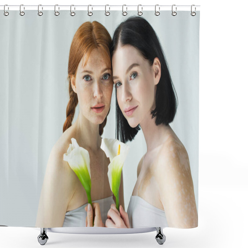 Personality  Body Positive Women With Freckles And Vitiligo Holding Flowers Isolated On Grey  Shower Curtains