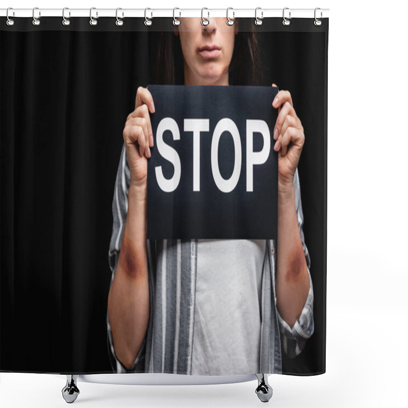 Personality  Cropped View Of Woman With Bruises On Hands Holding Card With Stop Lettering Isolated On Black  Shower Curtains