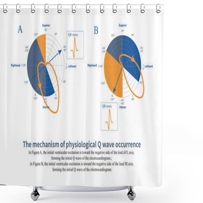 Personality  Under Normal Circumstances, When The Initial Excitation Potential Of The Ventricle Is Far Away From A Certain Lead Axis, A Q Wave Will Be Projected On That Lead, Which Is A Physiological Q Wave. Shower Curtains