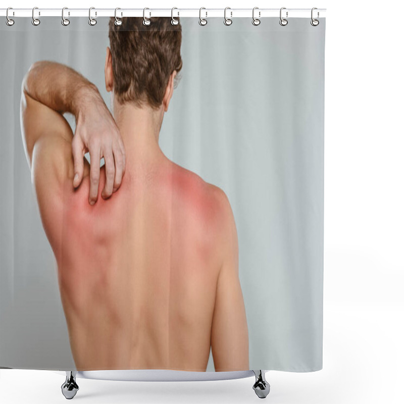 Personality  Back View Of Man Scratching Skin With Allergy Isolated On Grey Shower Curtains