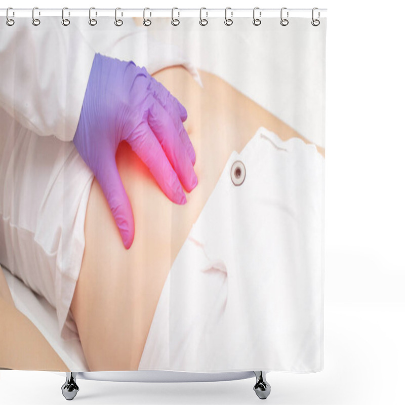 Personality  The Doctor Examines The Stomach Of The Girl Patient For The Presence Of Appendicitis. The Concept Of Abdominal Pain On The Right Side, Peritonitis, Surgery For Appendicitis Shower Curtains