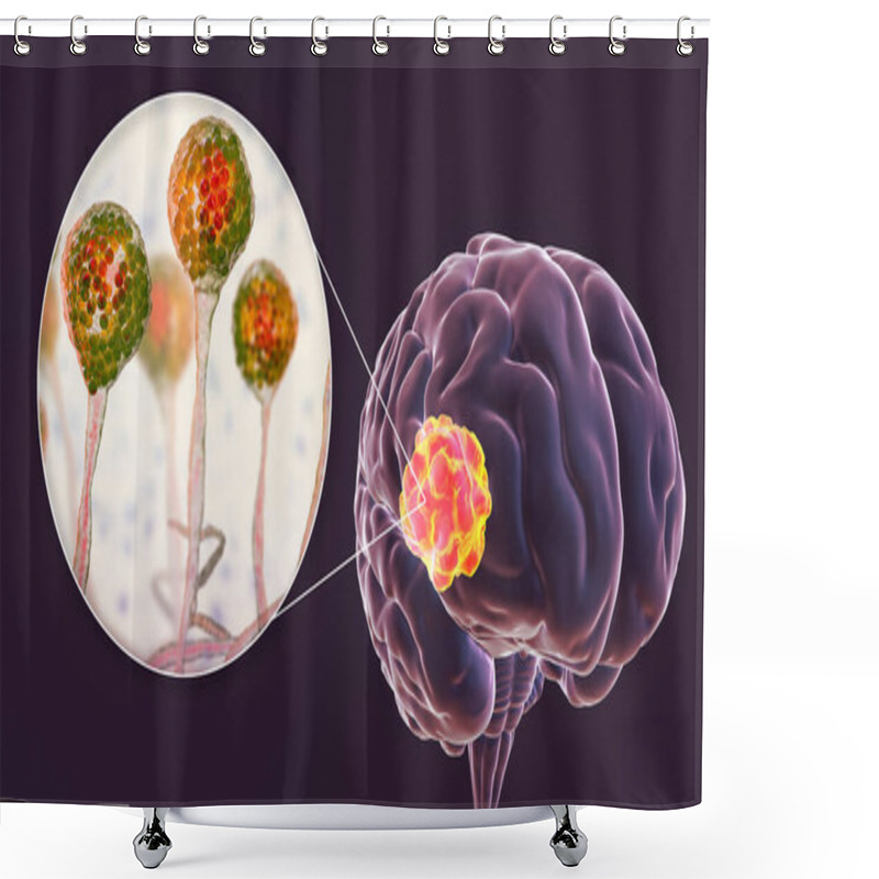 Personality  Brain Mucormycosis, A Brain Lesion Caused By Fungi Mucor, Also Known As Black Fungus, With Close-up View Of The Fungi, 3D Illustration. Complication After Covid-19 Shower Curtains