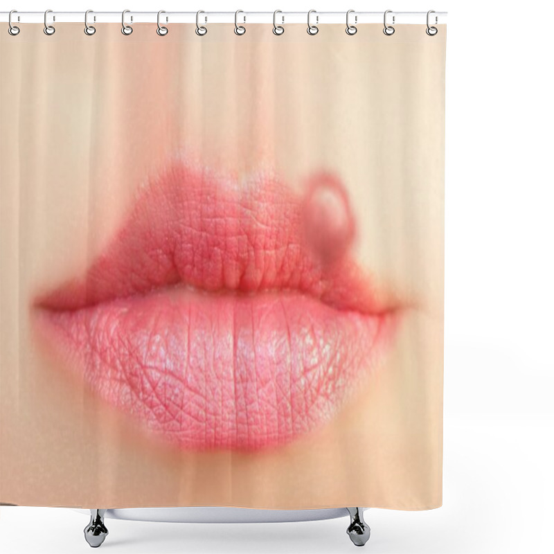 Personality  Closeup Of A Common Cold Sore Virus Herpes. Shower Curtains