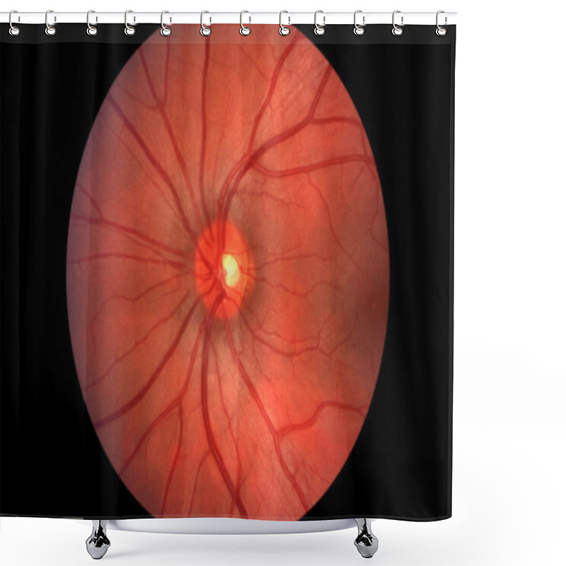 Personality  Human Retina - Optic Nerve Shower Curtains