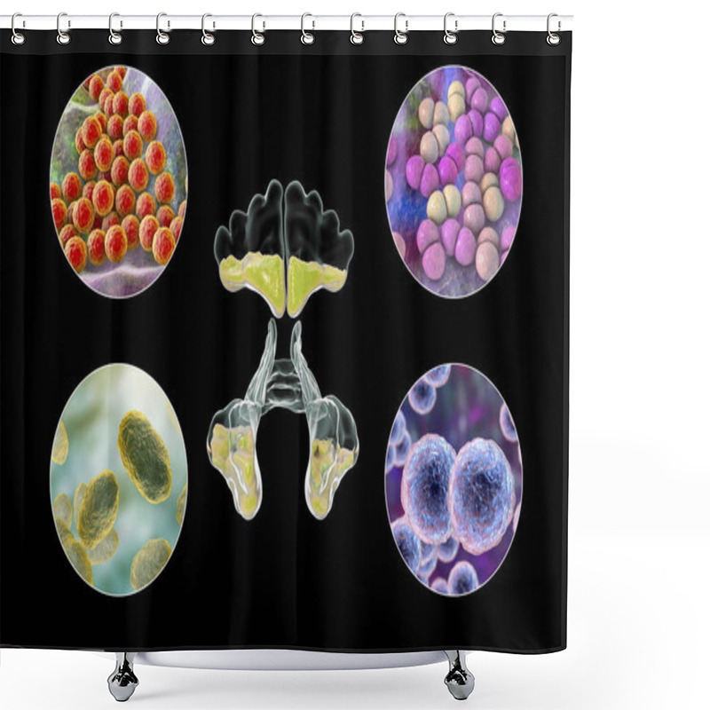 Personality  Anatomy Of Rhinosinusitis And Bacteria That Cause Sinusitis Staphylococcus Aureus, Streptococcus Pneumoniae, Haemophilus Influenzae, And Moraxella Catarrhalis, 3D Illustration Shower Curtains