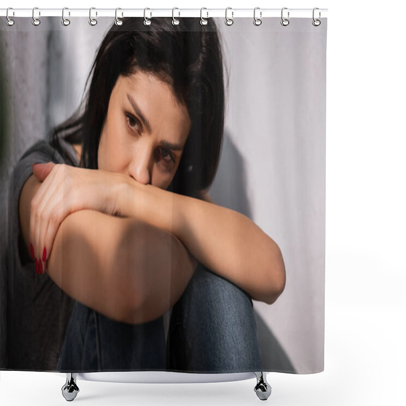 Personality  Depressed Woman With Bruise On Face, Domestic Violence Concept  Shower Curtains