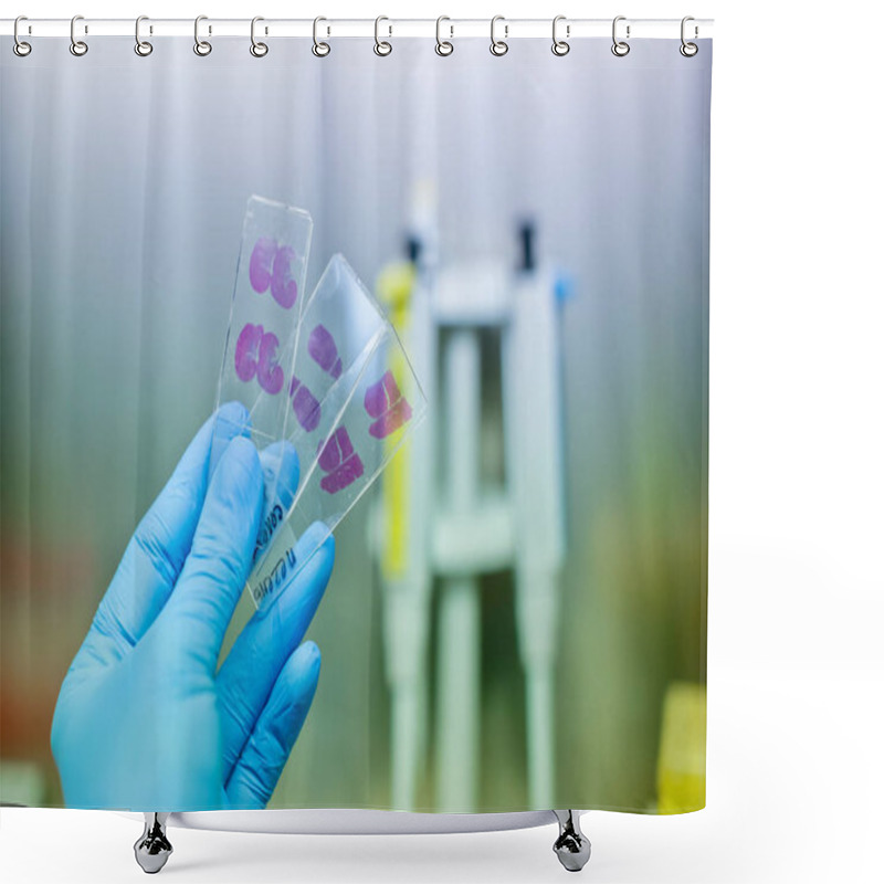 Personality  Hand In Blue Glove With Histological Rat Liver, Kidney An Spleen Tissue Samples Shower Curtains