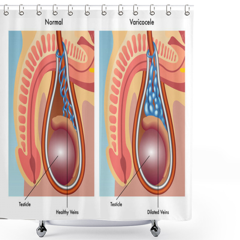 Personality  Human Varicocele Anatomy Shower Curtains