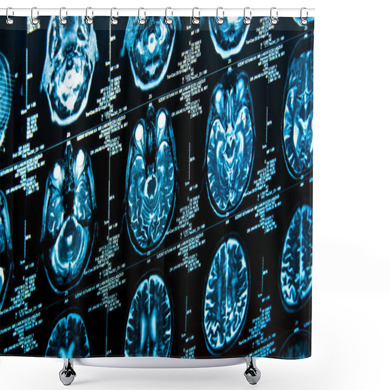 Personality  Closeup Of A Computer Axial Tomography Scan (CAT Scan) Shower Curtains