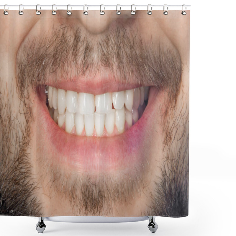 Personality  Tooth Smile Close Up. The Concept Of Healthy Proper Oral Hygiene Shower Curtains