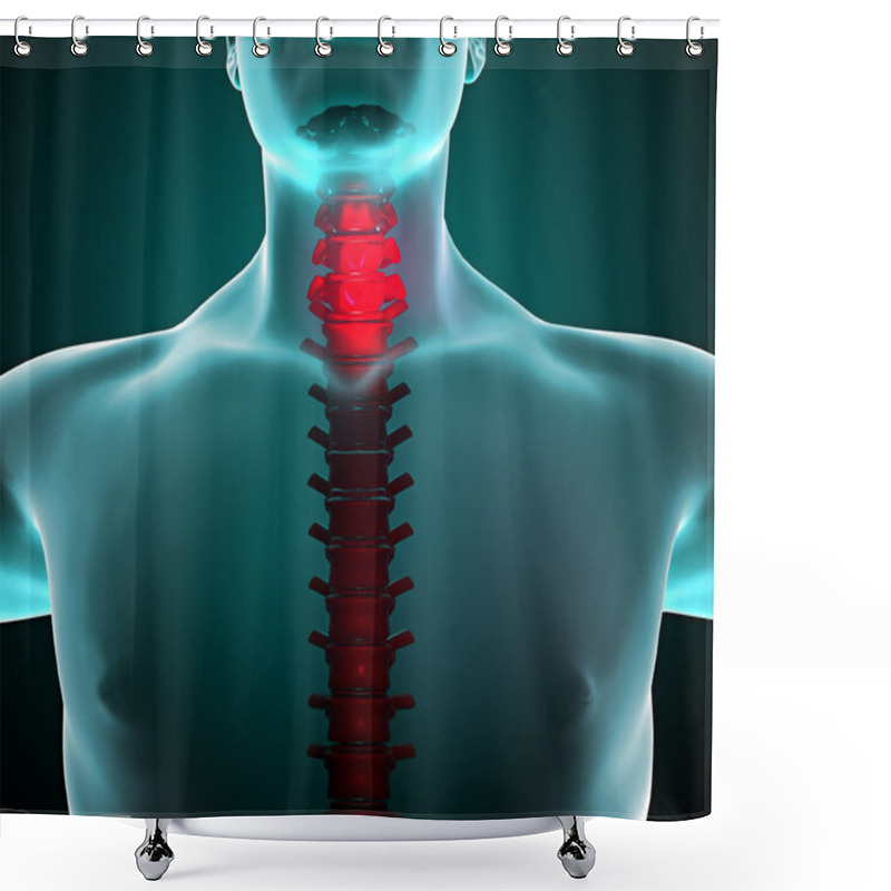 Personality  Pain In The Neck And Spine In A X-ray Vision Shower Curtains