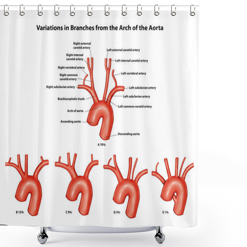 Personality  Variations In Branches From The Arch Of The Aorta Shower Curtains